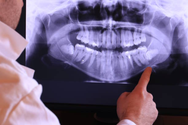 Best Emergency Dental Care for Sports Injuries in South Hooksett, NH